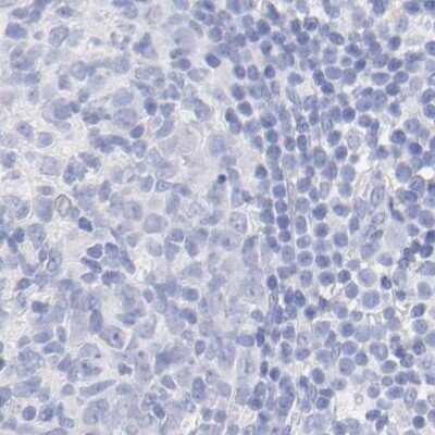 Immunohistochemistry-Paraffin: WDR65 Antibody [NBP1-82009] - Staining of human lymph node.