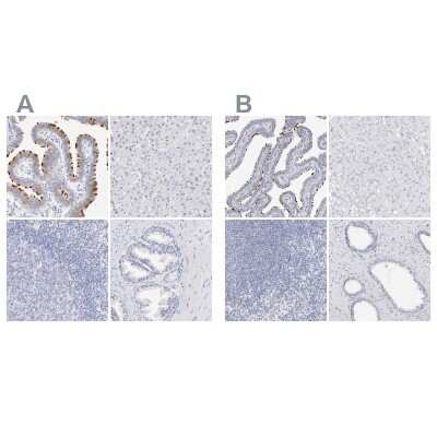 <b>Independent Antibodies Validation. </b>Immunohistochemistry-Paraffin: WDR65 Antibody [NBP1-82009] - Staining of human fallopian tube, liver, lymph node and prostate using Anti-WDR65 antibody NBP1-82009 (A) shows similar protein distribution across tissues to independent antibody NBP1-82008 (B).