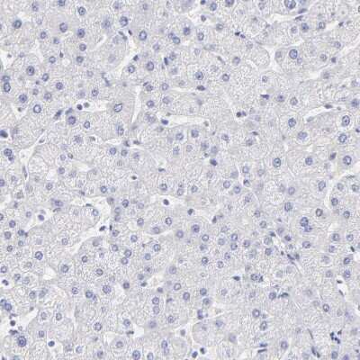 Immunohistochemistry-Paraffin: WDR65 Antibody [NBP1-82009] - Staining of human liver shows no positivity in hepatocytes as expected.