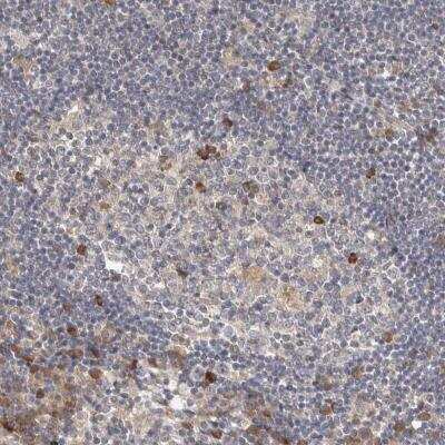 Immunohistochemistry: WDR67 Antibody [NBP1-81818] - Staining of human lymph node shows moderate cytoplasmic positivity in a subset of germinal center cells and non-germinal center cells.