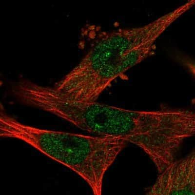 Immunocytochemistry/Immunofluorescence: WDR68 Antibody [NBP1-92589] - Staining of human cell line U-251MG shows positivity in nucleus but not nucleoli and cytoplasm.