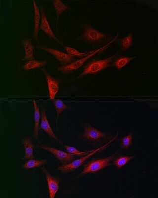 Immunocytochemistry/Immunofluorescence: WDR68 Antibody [NBP2-95210] - Immunofluorescence analysis of NIH/3T3 cells using WDR68 Rabbit pAb (NBP2-95210) at dilution of 1:150 (40x lens). Blue: DAPI for nuclear staining.