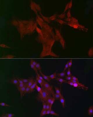 Immunocytochemistry/Immunofluorescence: WDR68 Antibody [NBP2-95210] - Immunofluorescence analysis of PC-12 cells using WDR68 Rabbit pAb (NBP2-95210) at dilution of 1:150 (40x lens). Blue: DAPI for nuclear staining.