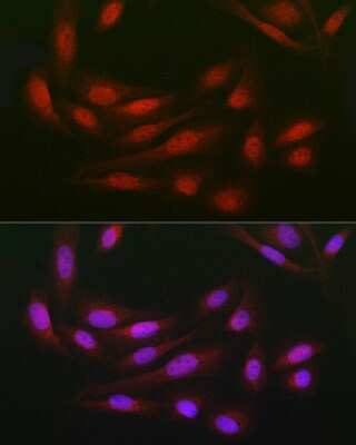 Immunocytochemistry/Immunofluorescence: WDR68 Antibody [NBP2-95210] - Immunofluorescence analysis of U2OS cells using WDR68 Rabbit pAb (NBP2-95210) at dilution of 1:150 (40x lens). Blue: DAPI for nuclear staining.