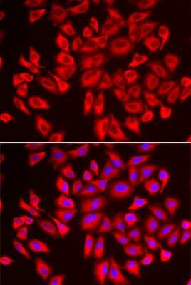 Immunocytochemistry/Immunofluorescence: WDR68 Antibody [NBP3-03460] - Analysis of U2OS cells using WDR68 antibody . Blue: DAPI for nuclear staining.