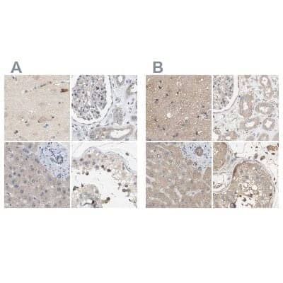 <b>Independent Antibodies Validation. </b>Immunohistochemistry-Paraffin: WDR68 Antibody [NBP1-92590] - Staining of human cerebral cortex, kidney, liver and testis using Anti-DCAF7 antibody NBP1-92590 (A) shows similar protein distribution across tissues to independent antibody NBP1-92589 (B).