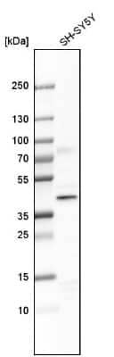 Western Blot: WDR68 Antibody [NBP1-92589] - Analysis in human cell line SH-SY5Y.