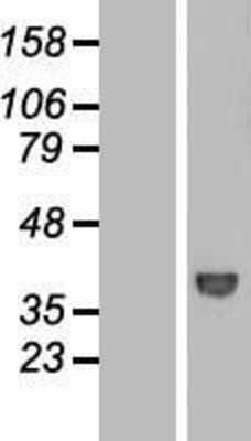 Western Blot: WDR68 Overexpression Lysate (Adult Normal) [NBL1-17825] Left-Empty vector transfected control cell lysate (HEK293 cell lysate); Right -Over-expression Lysate for WDR68.