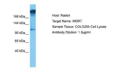 Western Blot WDR7 Antibody