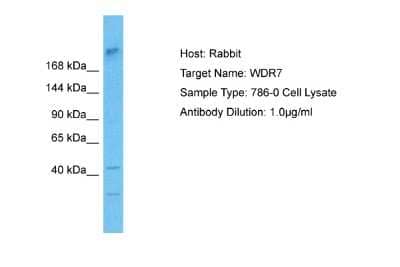 Western Blot WDR7 Antibody