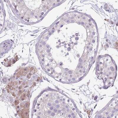 Immunohistochemistry: WDR70 Antibody [NBP2-48892] - Staining of human testis shows moderate cytoplasmic positivity in Leydig cells.