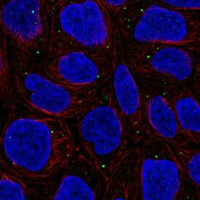 Immunocytochemistry/Immunofluorescence: WDR72 Antibody [NBP2-57458] - Staining of human cell line RT4 shows localization to vesicles.