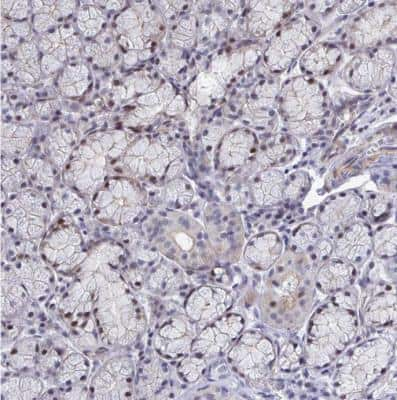 Immunohistochemistry-Paraffin: WDR72 Antibody [NBP2-31676] - Staining of human salivary gland shows moderate to strong nuclear positivity in acinar cells.