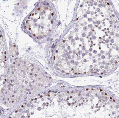 Immunohistochemistry-Paraffin: WDR72 Antibody [NBP2-31676] - Staining of human testis shows moderate to strong nuclear positivity in cells in seminiferous ducts.