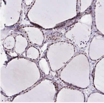 Immunohistochemistry-Paraffin: WDR72 Antibody [NBP2-31676] -  Staining of human thyroid gland shows moderate to strong nuclear positivity in follicular cells.