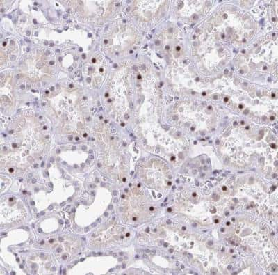 Immunohistochemistry-Paraffin: WDR72 Antibody [NBP2-31676] - Staining of human kidney shows moderate to strong nuclear positivity in cells in tubules.