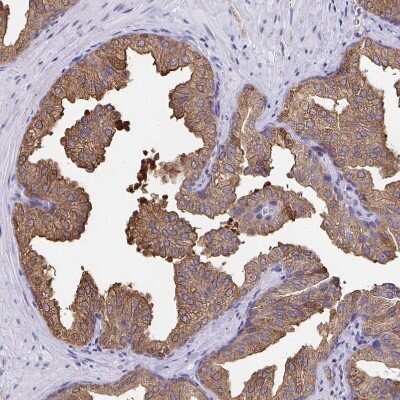 Immunohistochemistry-Paraffin: WDR72 Antibody [NBP2-31800] - Staining of human prostate shows strong cytoplasmic positivity in glandular cells.