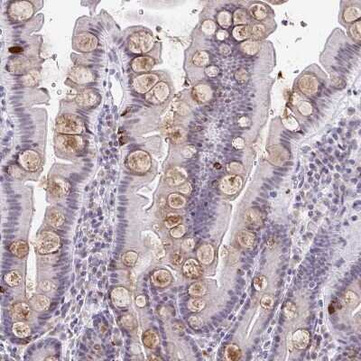 Immunohistochemistry-Paraffin: WDR72 Antibody [NBP2-31800] - Staining of human small intestine shows moderate cytoplasmic positivity in goblet cells.