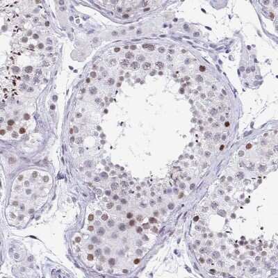 Immunohistochemistry-Paraffin: WDR72 Antibody [NBP2-31800] - Staining of human testis shows moderate nuclear positivity in cells in seminiferous ducts.