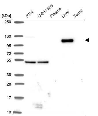 Western Blot: WDR72 Antibody [NBP2-31800] - Analysis in human cell line RT-4, human cell line U-251 MG, human plasma, human liver tissue and human tonsil tissue.