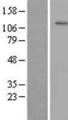 Western Blot: WDR72 Overexpression Lysate (Adult Normal) [NBL1-17827] Left-Empty vector transfected control cell lysate (HEK293 cell lysate); Right -Over-expression Lysate for WDR72.