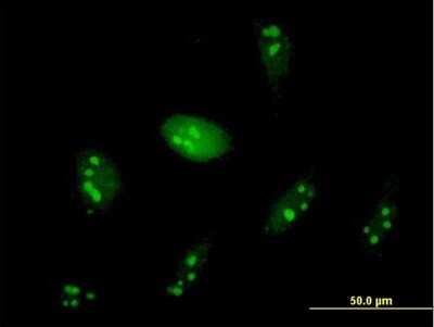 Immunocytochemistry/Immunofluorescence: WDR74 Antibody [H00054663-B01P] - Analysis of purified antibody to WDR74 on HeLa cell. (antibody concentration 10 ug/ml)