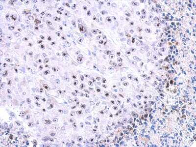Immunohistochemistry-Paraffin: WDR74 Antibody [NBP2-20900] - Immunohistochemical analysis of paraffin-embedded HBL435 xenograft, using antibody at 1:500 dilution.