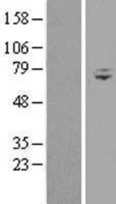 Western Blot: WDR76 Overexpression Lysate (Adult Normal) [NBL1-17830] Left-Empty vector transfected control cell lysate (HEK293 cell lysate); Right -Over-expression Lysate for WDR76.