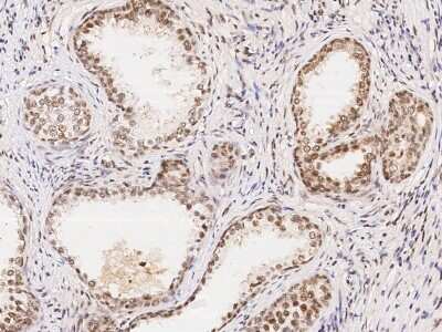 Immunohistochemistry-Paraffin: WDR77 Antibody [NBP2-98916] - Immunochemical staining of human WDR77 in human prostate with rabbit polyclonal antibody (1:1000, formalin-fixed paraffin embedded sections).