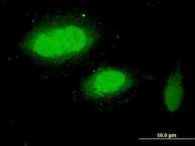 Immunocytochemistry/Immunofluorescence: WDR79 Antibody (1F12) [H00055135-M04] - Analysis of monoclonal antibody to WDR79 on HeLa cell. Antibody concentration 10 ug/ml