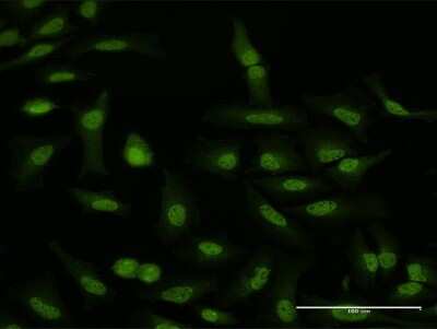 Immunocytochemistry/Immunofluorescence: WDR79 Antibody [H00055135-D01P] - Analysis of antibody to WDR79 on HeLa cell. Antibody concentration 10 ug/ml.