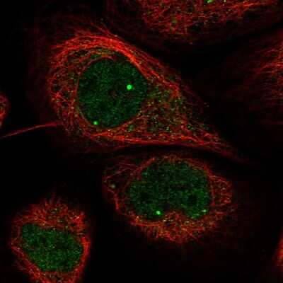 Immunocytochemistry/Immunofluorescence: WDR79 Antibody [NBP1-92592] - Staining of human cell line A-431 shows localization to nuclear bodies.