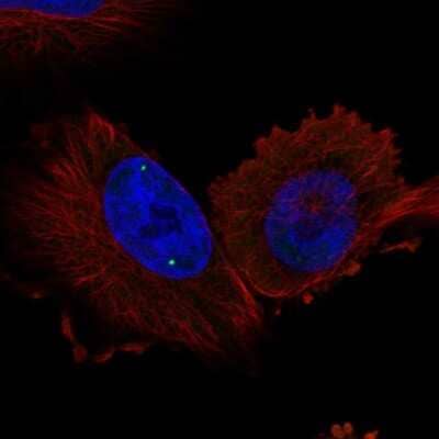 Immunocytochemistry/Immunofluorescence: WDR79 Antibody [NBP2-56099] - Staining of human cell line U-251 MG shows localization to nuclear bodies.