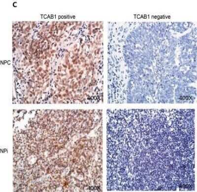 Immunohistochemistry: WDR79 Antibody [NB100-68252] - WDR79 (TCAB1) was overexpressed in cell lines and in tissues of head and neck cancers. The typical IHC results (Left: WDR79 (TCAB1) positive, Right: WDR79 (TCAB1) negative) of WDR79 (TCAB1) in human NPC and Npi. Image collected and cropped by CiteAb from the following publication (//molecular-cancer.biomedcentral.com/articles/10.1186/1476-4598-13-180), licensed under a CC-BY license.