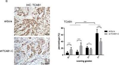 Immunohistochemistry: WDR79 Antibody [NB100-68252] - WDR79 (TCAB1) knockdown inhibits tumor growth in vivo. Performed IHC against WDR79 (TCAB1) using mice xenografts sections. The smaller tumors expressed less WDR79 (TCAB1) compared to shScra cells. Statistical analysis of the IHC data used Aperio ImageScope software and all of the data were determined by Student's t test (*P < 0.05, **P < 0.01, ***P < 0.005). Image collected and cropped by CiteAb from the following publication (//molecular-cancer.biomedcentral.com/articles/10.1186/1476-4598-13-180), licensed under a CC-BY license.