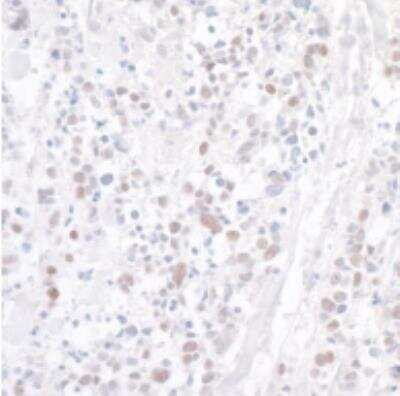 Immunohistochemistry-Paraffin WDR79 Antibody