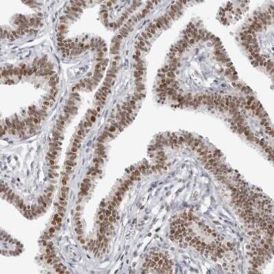 Immunohistochemistry-Paraffin: WDR79 Antibody [NBP1-92592] - Staining of human Fallopian tube shows moderate nuclear positivity in glandular cells.