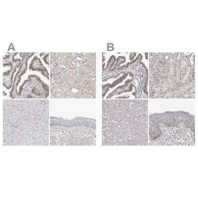 <b>Independent Antibodies Validation. </b>Immunohistochemistry-Paraffin: WDR79 Antibody [NBP1-92592] - Staining of human fallopian tube, kidney, liver and skin using Anti-WRAP53 antibody NBP1-92592 (A) shows similar protein distribution across tissues to independent antibody NBP1-92593 (B).