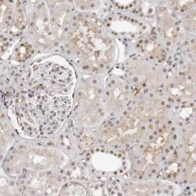 Immunohistochemistry-Paraffin: WDR79 Antibody [NBP1-92592] - Staining of human kidney shows weak to moderate nuclear positivity in cells in tubules.