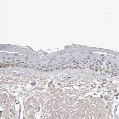 Immunohistochemistry-Paraffin: WDR79 Antibody [NBP1-92592] - Staining of human skin shows weak nuclear positivity in squamous epithelial cells.