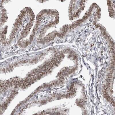 Immunohistochemistry-Paraffin: WDR79 Antibody [NBP1-92593] - Staining of human Fallopian tube shows moderate nuclear positivity in glandular cells.