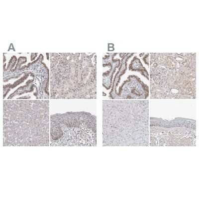 <b>Independent Antibodies Validation. </b>Immunohistochemistry-Paraffin: WDR79 Antibody [NBP1-92593] - Staining of human fallopian tube, kidney, liver and skin using Anti-WRAP53 antibody NBP1-92593 (A) shows similar protein distribution across tissues to independent antibody NBP1-92592 (B).