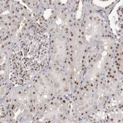 Immunohistochemistry-Paraffin: WDR79 Antibody [NBP1-92593] - Staining of human kidney shows weak to moderate nuclear positivity in cells in tubules.