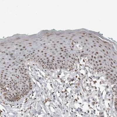 Immunohistochemistry-Paraffin: WDR79 Antibody [NBP1-92593] - Staining of human skin shows weak to moderate nuclear positivity in squamous epithelial cells.