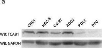 Western Blot: WDR79 Antibody [NB100-68252] - WDR79 (TCAB1) was overexpressed in cell lines and in tissues of head and neck cancers. Protein level of WDR79 (TCAB1) in head and neck cancer cell lines (the first 4 samples) compared to human normal primary cells (the last 2 samples). Image collected and cropped by CiteAb from the following publication (//molecular-cancer.biomedcentral.com/articles/10.1186/1476-4598-13-180), licensed under a CC-BY license.