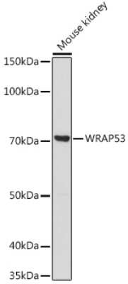 Western Blot: WDR79 Antibody [NBP3-15968] - Western blot analysis of extracts of Mouse kidney, using WDR79 antibody (NBP3-15968) at 1:1000 dilution. Secondary antibody: HRP Goat Anti-Rabbit IgG (H+L) at 1:10000 dilution. Lysates/proteins: 25ug per lane. Blocking buffer: 3% nonfat dry milk in TBST. Detection: ECL Basic Kit. Exposure time: 180s.