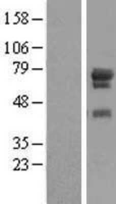 Western Blot: WDR79 Overexpression Lysate (Adult Normal) [NBL1-17832] Left-Empty vector transfected control cell lysate (HEK293 cell lysate); Right -Over-expression Lysate for WDR79.