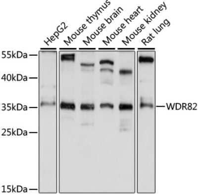 Western Blot: WDR82 Antibody [NBP2-93148] - Analysis of extracts of various cell lines, using WDR82 at 1:1000 dilution. Secondary antibody: HRP Goat Anti-Rabbit IgG (H+L) at 1:10000 dilution. Lysates/proteins: 25ug per lane. Blocking buffer: 3% nonfat dry milk in TBST. Detection: ECL Basic Kit . Exposure time: 10s.