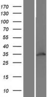 Western Blot WDR82 Overexpression Lysate