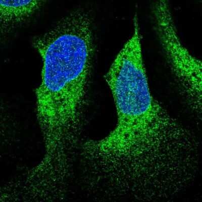 Immunocytochemistry/Immunofluorescence: WDR83OS Antibody [NBP2-55905] - Staining of human cell line U-2 OS shows localization to nuclear membrane & endoplasmic reticulum.